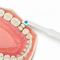 Medicom SafeMatrix Single-Use Matrix Band 50/Box