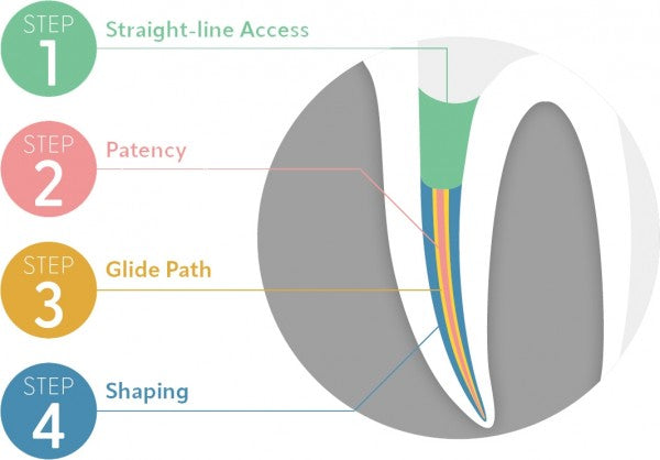 Mani Jizai NiTi Rotary files 0.6 Taper 3 Pcs/Pk - 31mm